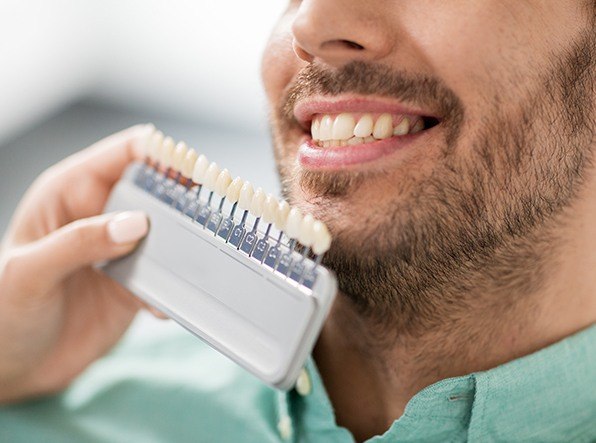 veneer chart in front of man's smile